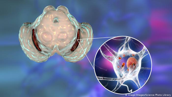 stem cells  parkinsons