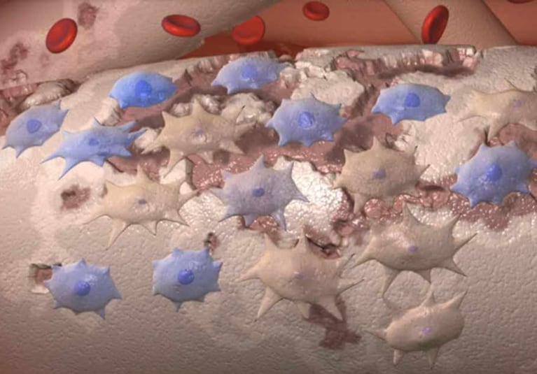 Exosomes stem cells culture-expanded-adipose-mesenchymal-stem-cells-767px