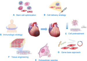 Stem Cells Treatment for Heart Failure